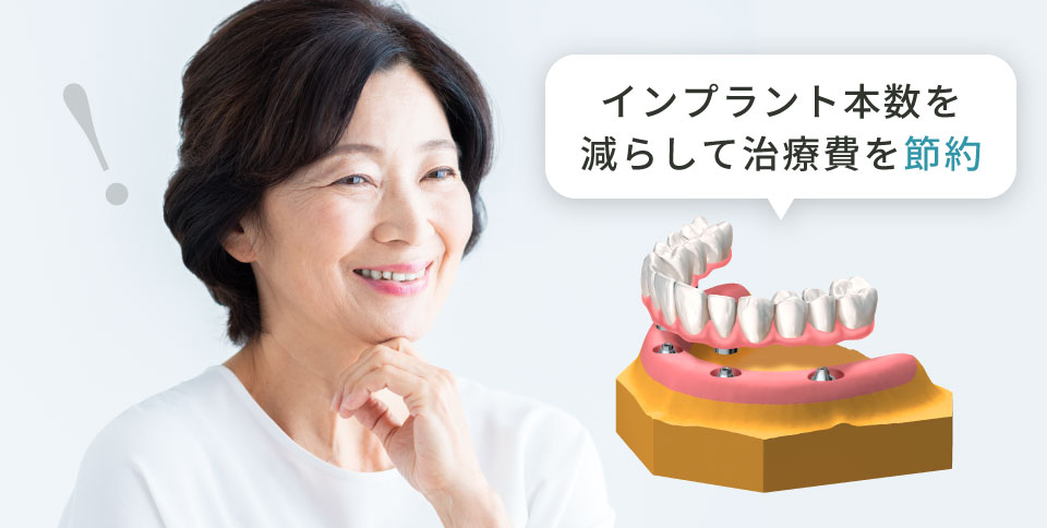 インプラント本数を減らして治療費を節約