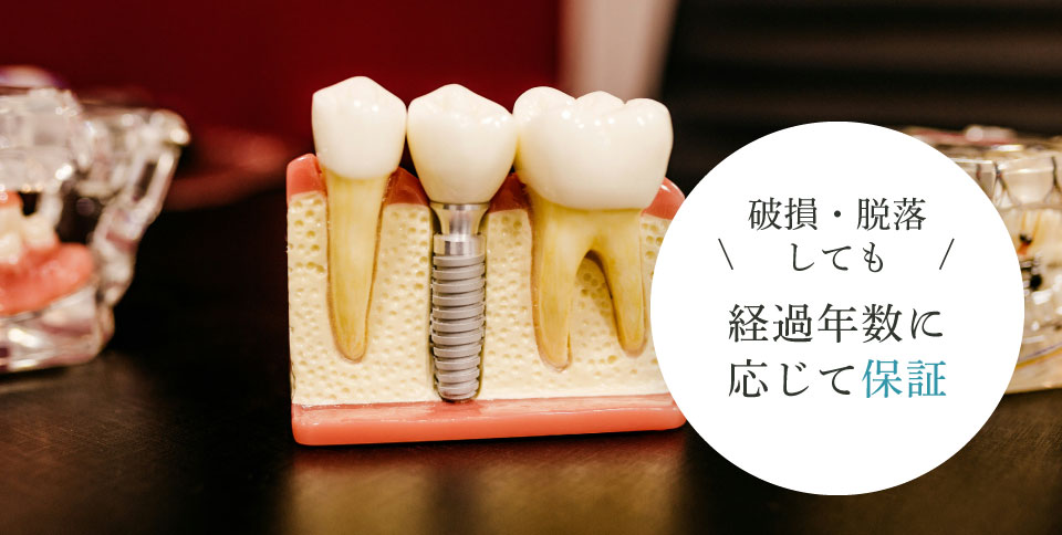 破損・脱落しても、経過年数に応じて保証